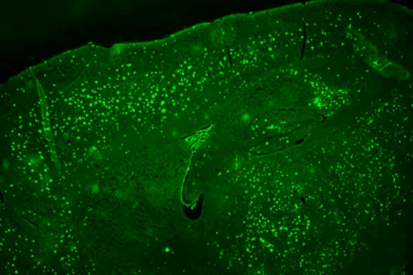 Alzheimer’s disease mouse model with plaques